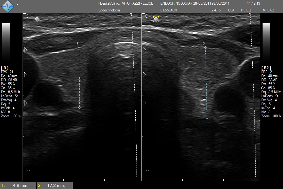 Telemed | ClarUs scanners