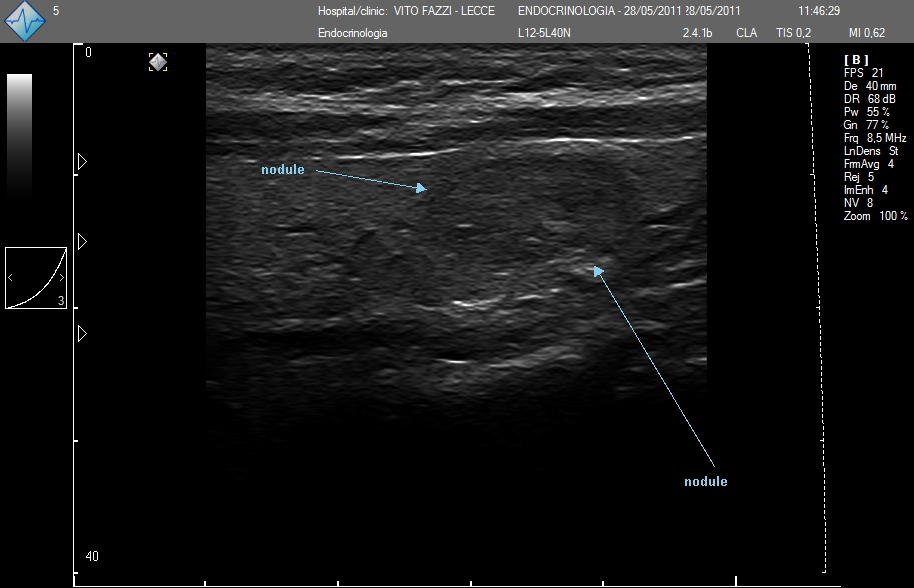 Telemed | ClarUs scanners