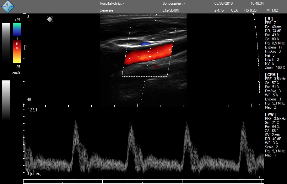 Telemed | ClarUs scanners