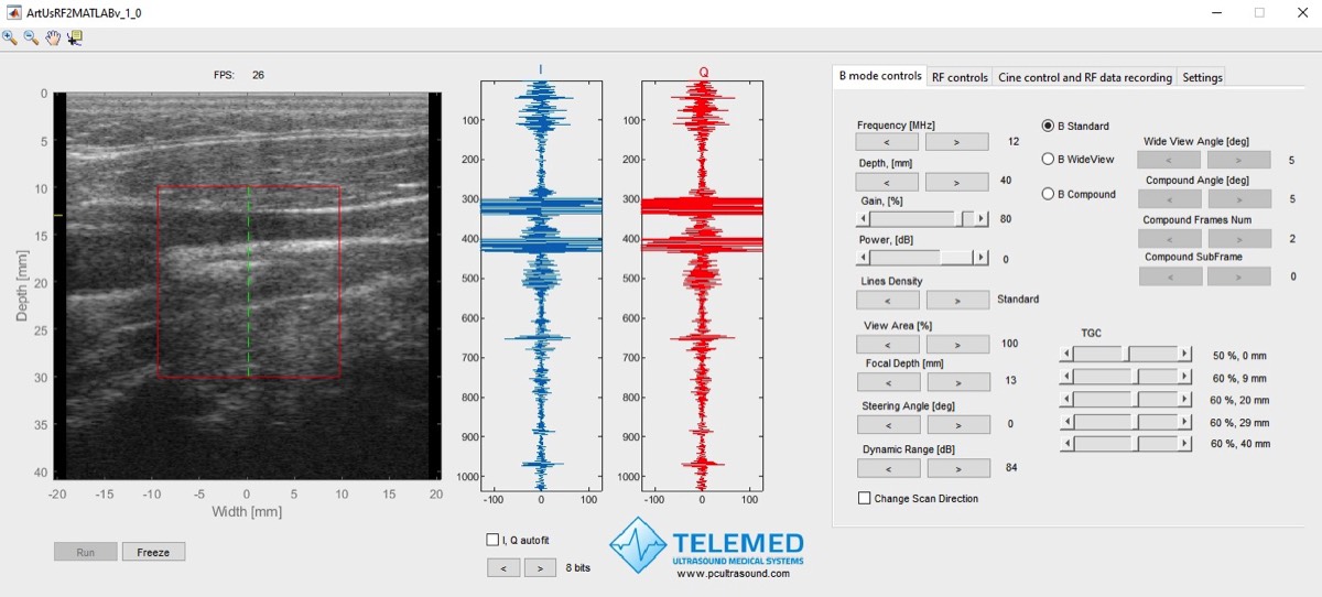 MATLAB — RF data control